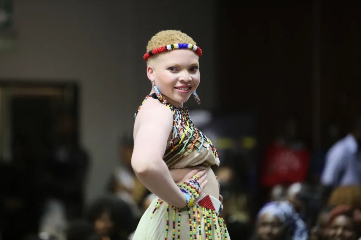 Pageant empowers people with albinism to stand tall in Zimbabwe