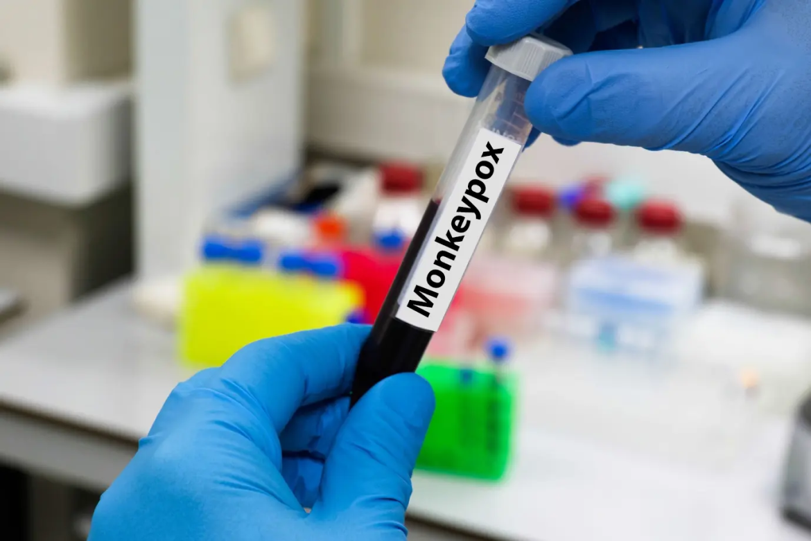 Africa CDC urges aggressive action to curb mpox outbreak in southern Ethiopia