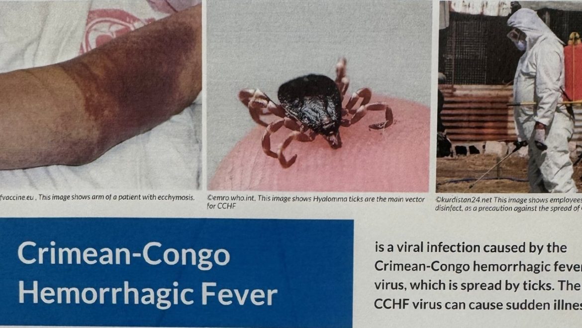 Iraq reports 313 Crimean-Congo hemorrhagic fever cases, 24 deaths